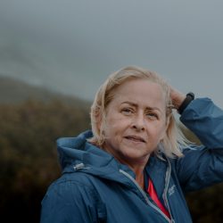 Perimenopause skincare for sensitive skin